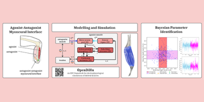Modeling, simulation and optimization of agonist-antagonist myoneural interface amputations